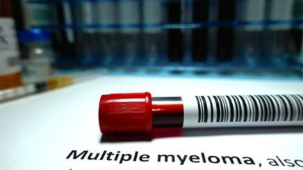 Multiple Myeloma Research